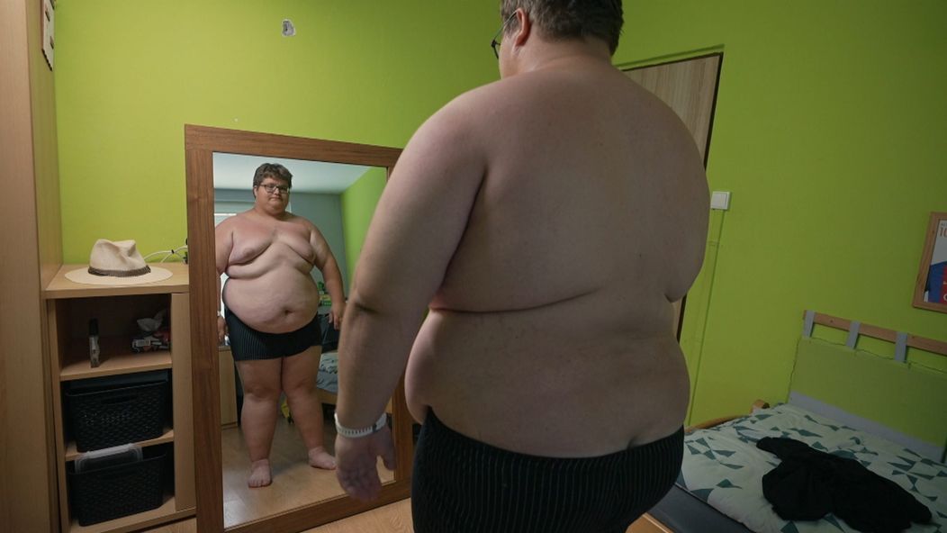Jardu obezita trápí. 