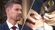 NEVIDĚLI JSTE V TV: Záběry z operace křečových žil jsou jen pro silné žaludky! Podívejte se na sál