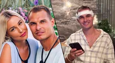 Martin Koči z Love Islandu podstoupil transplantaci vlasů
