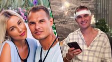 Martin Koči z Love Islandu podstoupil transplantaci vlasů