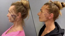Je to venku! Alice Bendová ukázala tvář po faceliftu