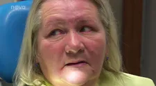 Šokovaný zubař o Hančiných zubech: Je tam špatně úplně všechno! VIDEO