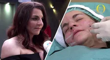 NEBYLO V TV: Podívejte se, co Petře strkali pod kůži na obličeji. Jen pro silné povahy!