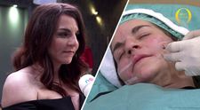 NEBYLO V TV: Podívejte se, co Petře strkali pod kůži na obličeji. Jen pro silné povahy!