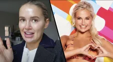 Hvězda Love Islandu s botoxem začala už v sedmnácti. Teď věří přírodě