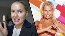 Hvězda Love Islandu s botoxem začala už v sedmnácti. Teď věří přírodě