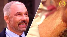 NEVIDĚLI JSTE V TV: Není se čeho bát! Autentické záběry z operace váčků pod očima vás přesvědčí