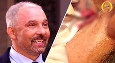 NEVIDĚLI JSTE V TV: Není se čeho bát! Autentické záběry z operace váčků pod očima vás přesvědčí
