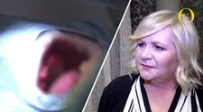 NEBYLO V TV: Krvavé záběry Hančiny bezzubé čelisti vás vyděsí!