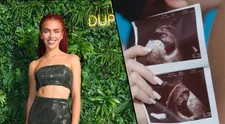 Rachel z Love Islandu je těhotná. Sdílela dojemný snímek z ultrazvuku