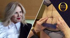 NEVIDĚLI JSTE V TV: Podívejte se na záběry z Daniny liposukce bez cenzury!