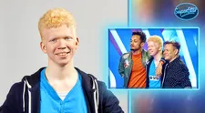 Nové brýle pro Matyáše i víc. Jak dopadla sbírka pro skromného albína ze SuperStar?