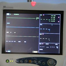 Ordinace: Dramatická smrt Ilony - 5