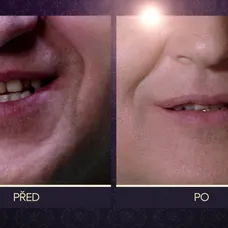 O 10 let mladší - PŘED A PO_ DANA A VLADIMÍR - 8
