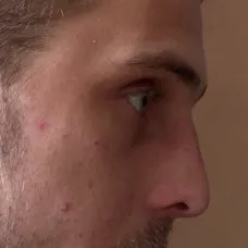 Výměna manželek: Smrtelná autonehoda! - 3