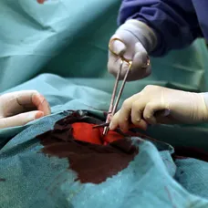 Ordinace: Zákulisí natáčení operace - 12