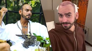 Neuvěřitelná proměna Bandurka ze Survivora: V Turecku si nechal nastřelit vlasy