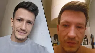 Bachelor Solfronk prošel extrémní proměnou. Takhle se zbavil lupénky