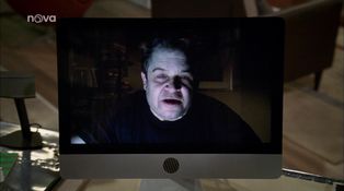 18. díl - Válka se zánětem dásní