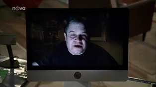 18. díl - Válka se zánětem dásní