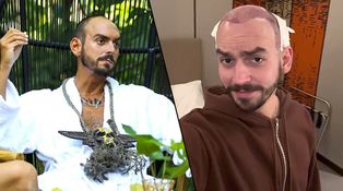 Neuvěřitelná proměna Bandurka ze Survivora: V Turecku si nechal nastřelit vlasy