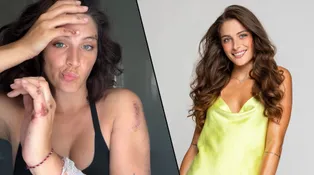 Děsivá nehoda Paulíny z Love Islandu: Spadla ze skútru