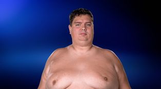 Jakub trpěl obezitou od dětství. Nedokáže bojovat sám se sebou