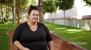 Zuzana míří do Proměn. Hubne kvůli roztroušené skleróze