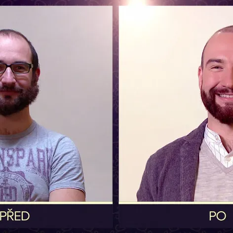 O 10 let mladší - Před a Po - Drahomíra a Tomáš