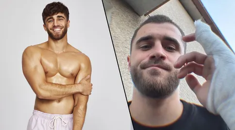 Děsivé zranění Lua z Love Islandu: Hrozila mu operace