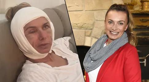 Co se stalo Alici Bendové? Fanoušci tipují facelift i nehodu na kole