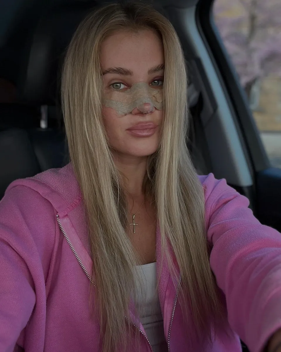 Johanka přiznala na svém Instagramu plastiku nosu.