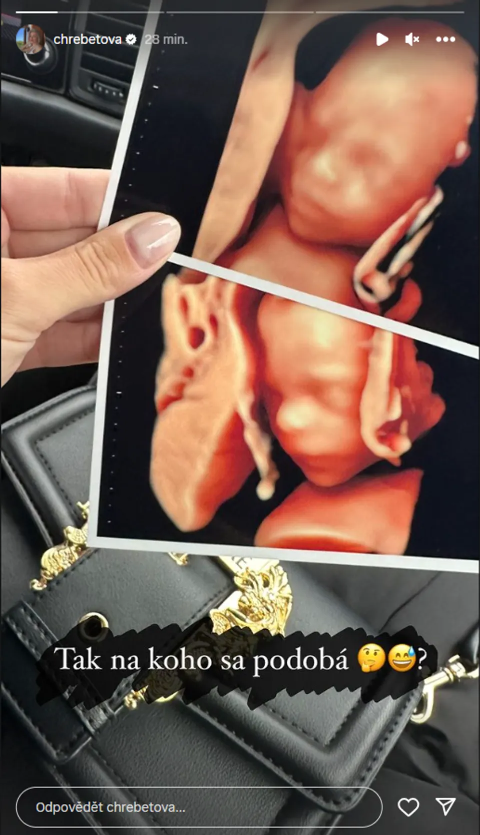 Laura ukázala fotografii miminka z ultrazvuku