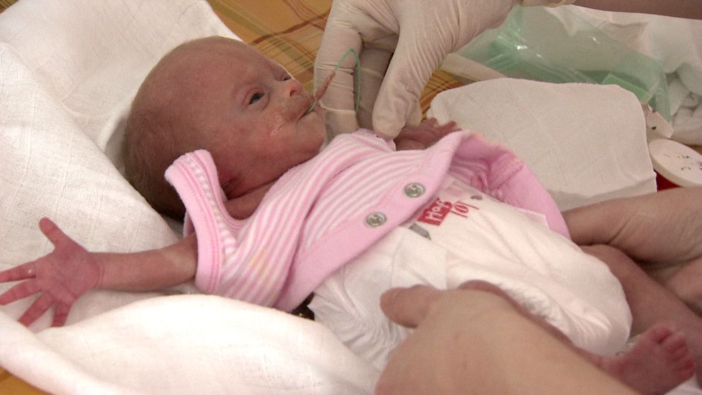 PÁR GRAMŮ ŽIVOTA: Jak se bojuje o život předčasně narozených dětí?