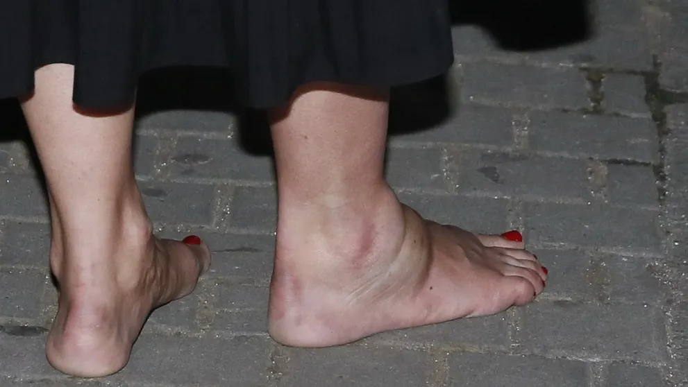 Tereza Brodská nenastoupila k natáčení Ulice. Vážně se zranila!