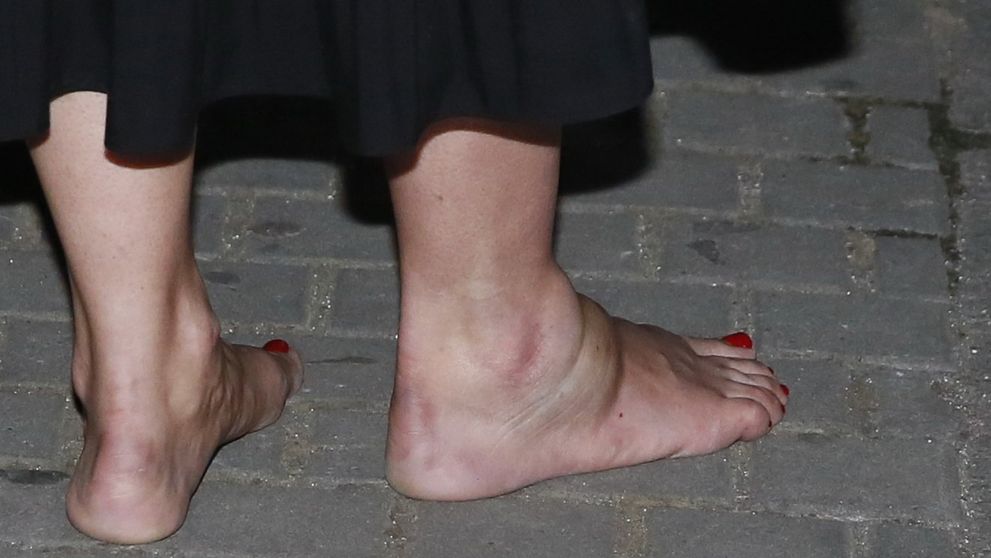 Tereza Brodská nenastoupila k natáčení Ulice. Vážně se zranila!