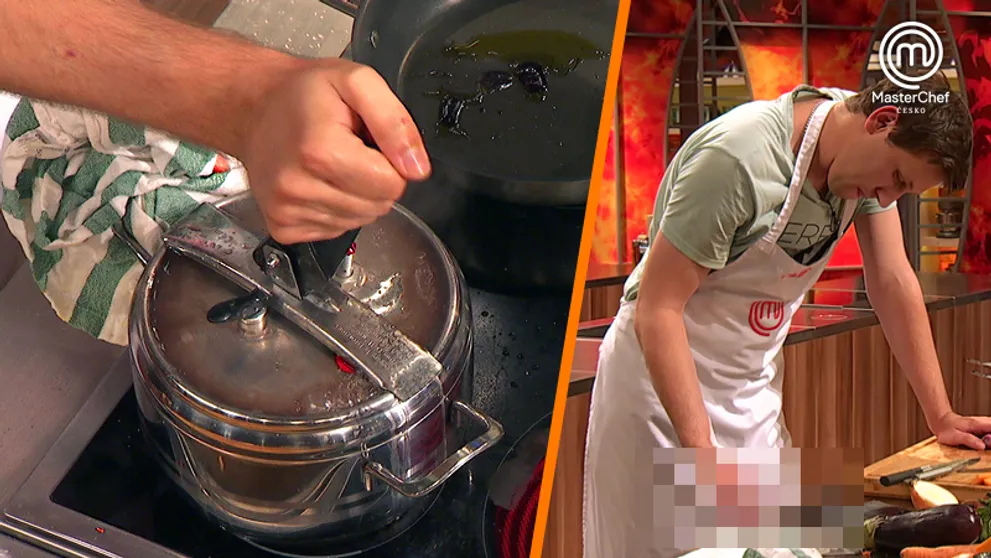 FOTO: MasterChef se mění v drama. Popálen je soutěžící i kameraman!