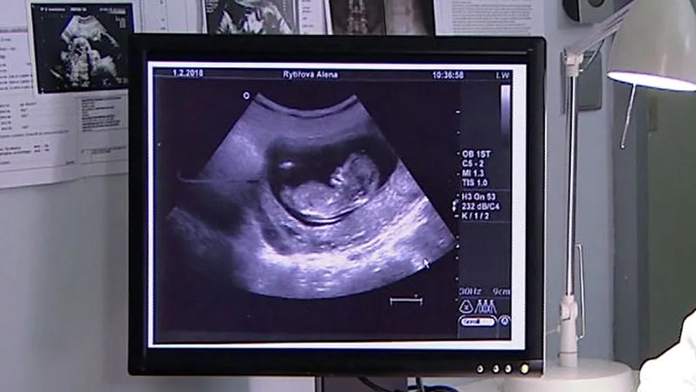 DEN D V ORDINACI NASTAL: Ne jeden, rovnou tři tátové se dnes mohou zrodit