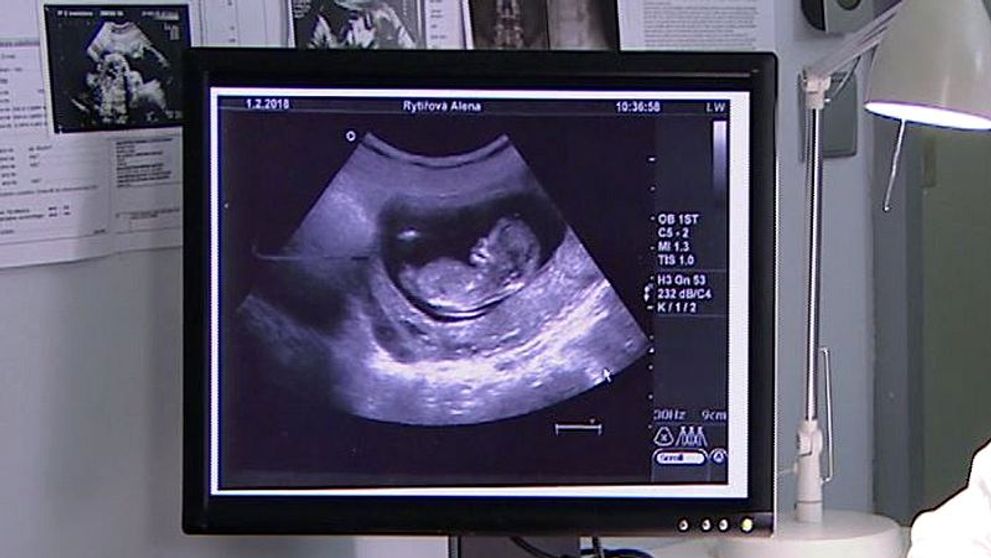 DEN D V ORDINACI NASTAL: Ne jeden, rovnou tři tátové se dnes mohou zrodit